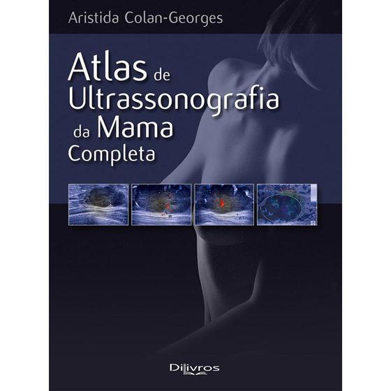 Imagem de Livro Atlas De Ultrassonografia Da Mama Completa - Di Livros