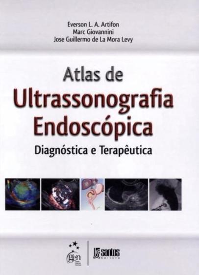 Imagem de Livro - Atlas de Ultrassonografia Endoscópica Diagnóstica e Terapêutica