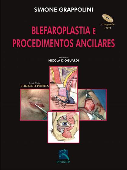Imagem de Livro - Blefaroplastia e Procedimentos Ancilares