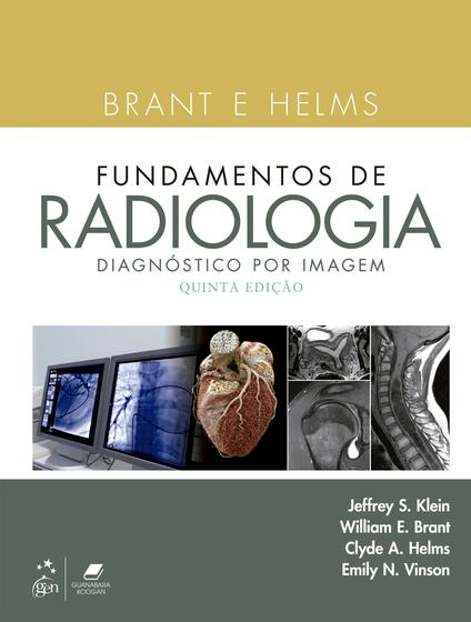 Imagem de Livro - Brant e Helms Fundamentos de Radiologia - Diagnóstico por Imagem