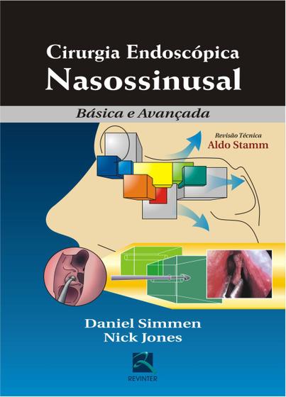 Imagem de Livro - Cirurgia Endoscópica Nasossinusal
