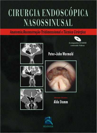 Imagem de Livro - Cirurgia Endoscopica Nasossinusal