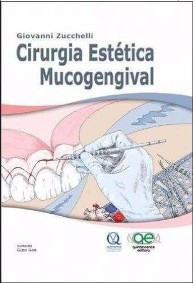 Imagem de Livro Cirurgia Estética Mucogengival Giovanni Zucchelli - Quintessence