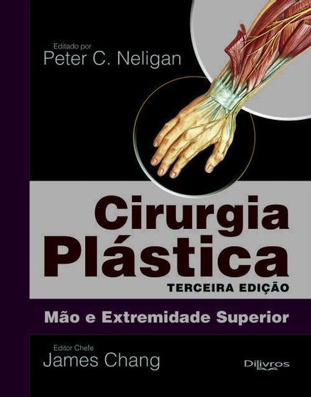 Imagem de Livro Cirurgia Plastica De Mao E Extremidade Superior Vol 6 - Di Livros