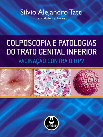 Imagem de Livro - Colposcopia e Patologias do Trato Genital Inferior
