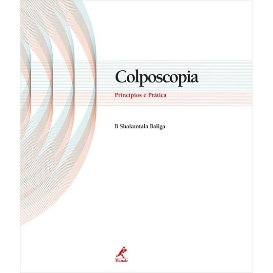Imagem de Livro - Colposcopia