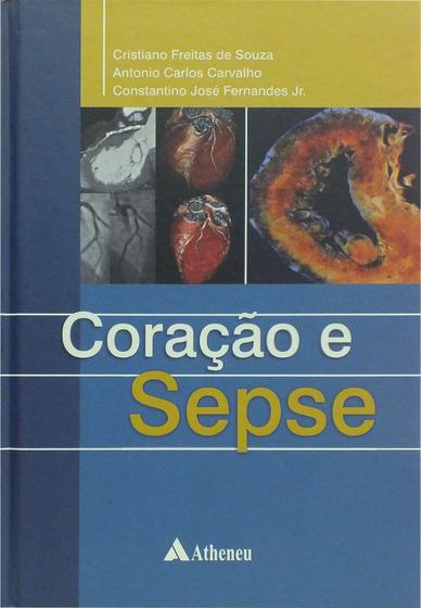 Imagem de Livro - Coração e Sepse