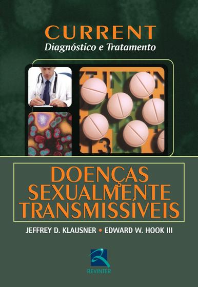 Imagem de Livro - Current Doenças Sexualmente Transmissíveis