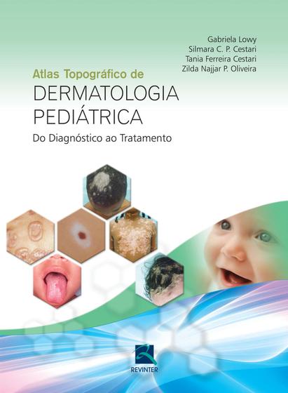 Livro - Dermatologia Pediátrica Menor preço em Livro - Dermatologia Pediátrica