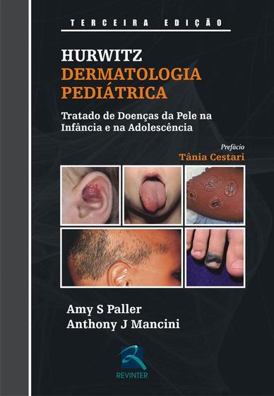 Imagem de Livro - Dermatologia Pediátrica