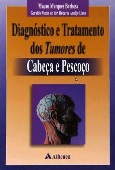 Imagem de Livro - Diagnóstico e Tratamento dos Tumores de Cabeça e Pescoço