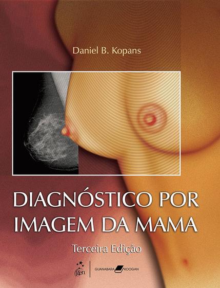 Imagem de Livro - Diagnóstico por Imagem da Mama