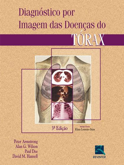 Imagem de Livro - Diagnóstico por Imagem das Doenças do Tórax