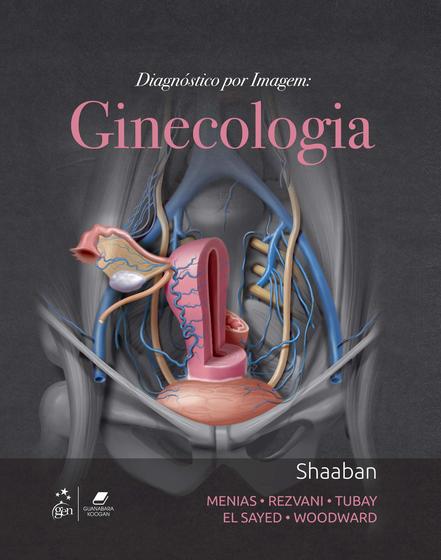 Imagem de Livro - Diagnóstico por Imagem: Ginecologia