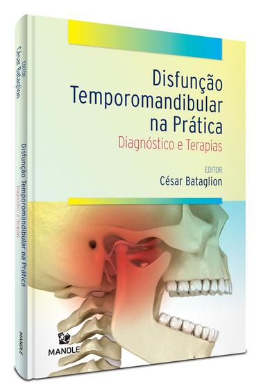Imagem de Livro - Disfunção temporomandibular na prática- diadnóstico e terapias