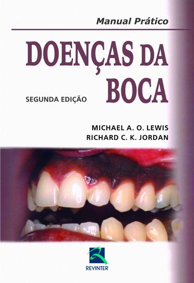 Imagem de Livro - Doenças da Boca