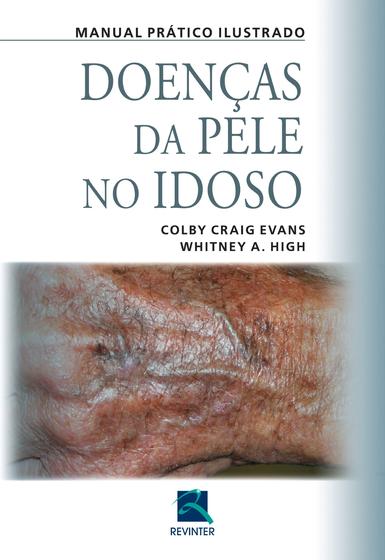 Imagem de Livro - Doenças da Pele no Idoso
