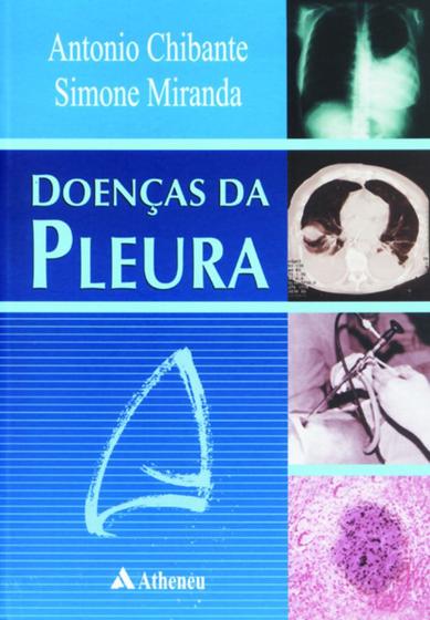 Imagem de Livro - Doenças da pleura