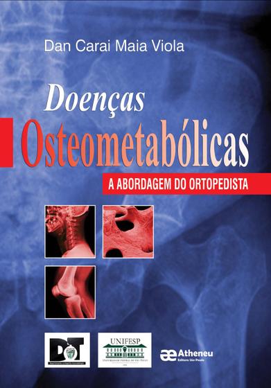 Imagem de Livro - Doenças osteometabólicas
