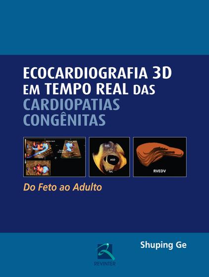 Livro - Ecocardiografia 3D em Tempo Real das Cardiopatias Congênitas Menor preço em Livro - Ecocardiografia 3D em Tempo Real das Cardiopatias Congênitas