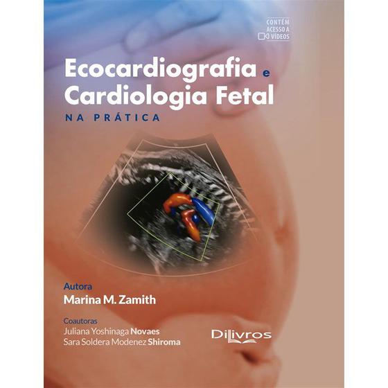 Imagem de Livro Ecocardiografia e Cardiologia Fetal na Prática - Zamith - Dilivros -  