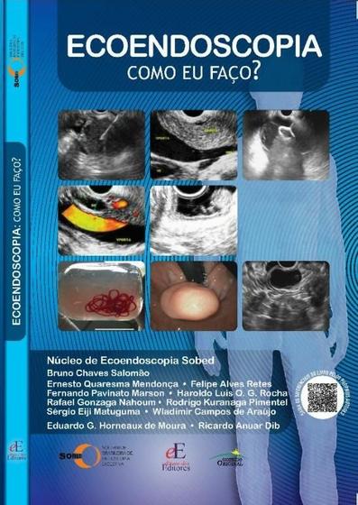 Imagem de Livro - Ecoendoscopia como eu faço?