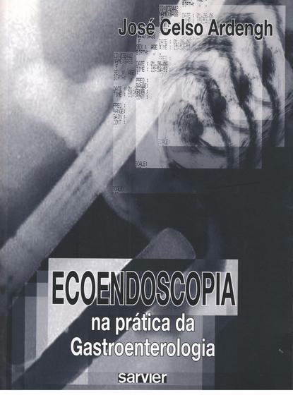 Imagem de Livro - Ecoendoscopia na prática da Gastroenterologia