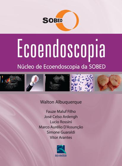 Imagem de Livro - Ecoendoscopia