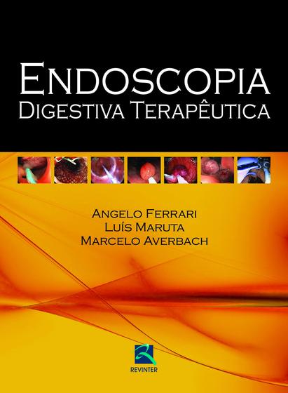 Imagem de Livro - Endoscopia Digestiva Terapêutica