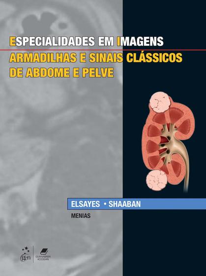 Imagem de Livro - Especialidades em Imagens - Armadilhas e Sinais Clássicos de Abdome e Pelve