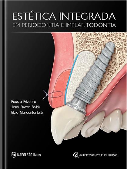 Imagem de Livro Estética Integrada Em Periodontia E Implantodontia - Napoleão