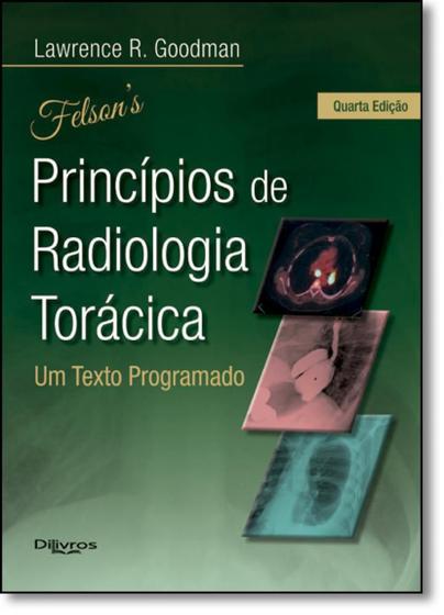 Imagem de Livro Felson Principios De Radiologia Toracica - Di Livros