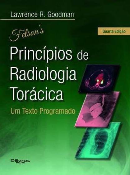 Imagem de Livro Felson Principios De Radiologia Toracica - Di Livros