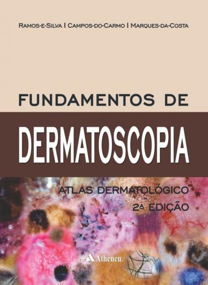 Imagem de Livro - Fundamentos de Dermatoscopia