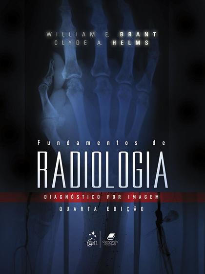 Imagem de Livro - Fundamentos de Radiologia