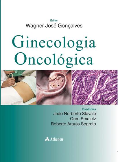 Imagem de Livro - Ginecologia oncológica