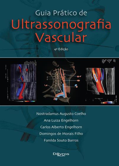 Imagem de Livro - Guia Prático de Ultrassonografia Vascular - Nostradamus - DiLivros