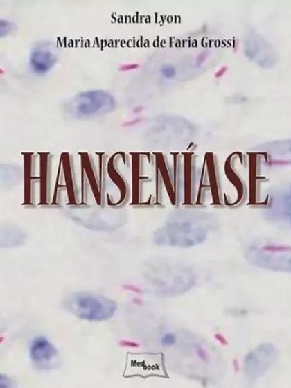 Imagem de Livro - Hanseníase