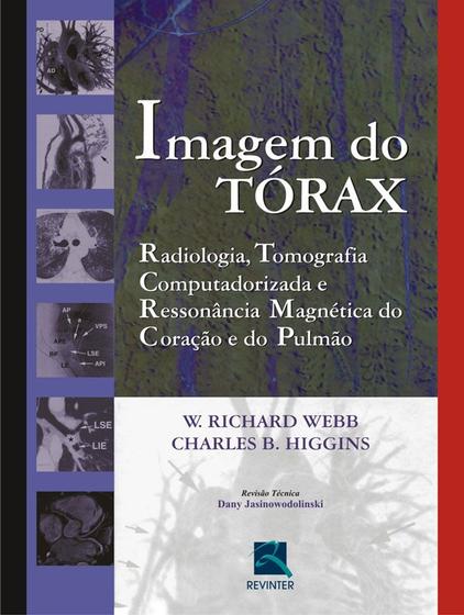Livro - Imagem do Tórax Menor preço em Livro - Imagem do Tórax