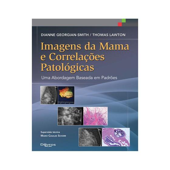 Imagem de Livro - Imagens da Mama e Correlações Patológicas - Uma Abordagem Baseada em Padrões - Smith - DiLivros