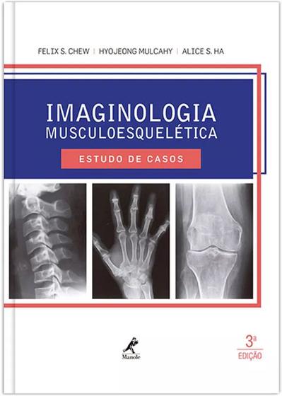 Imagem de Livro - Imaginologia musculoesquelética