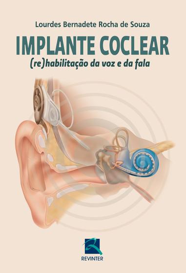 Imagem de Livro - Implante Coclear
