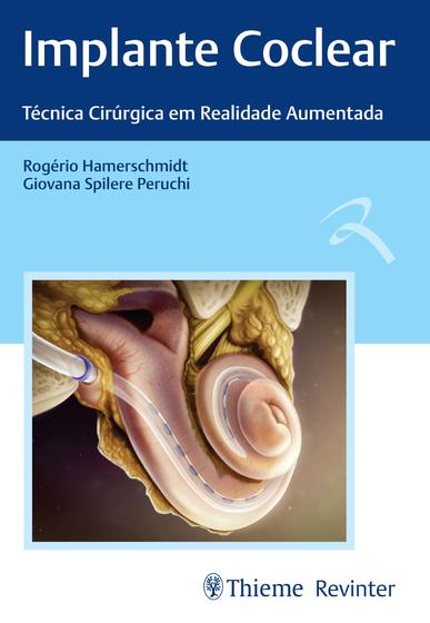 Imagem de Livro - Implante Coclear