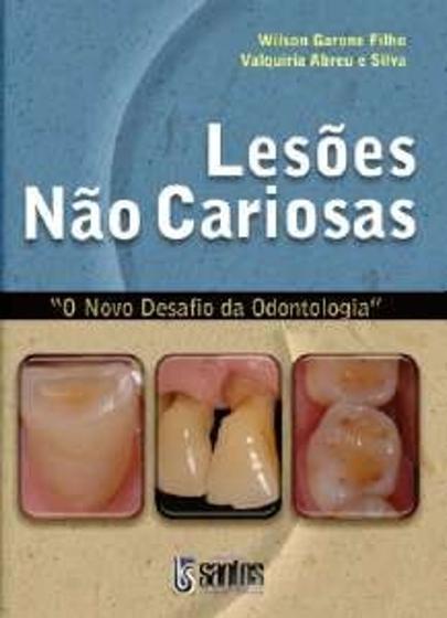 Imagem de Livro: Lesões Não Cariosas - O Novo Desafio Da Odontologia - Wilson Garone Filho E Valquíria Abreu - SANTOS - GRUPO GEN