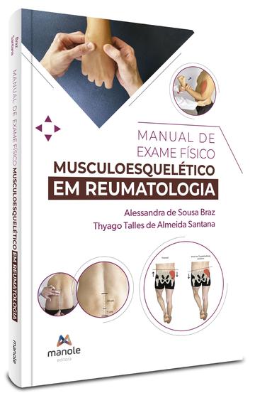 Imagem de Livro - Manual de Exame Físico Musculoesquelético em Reumatologia