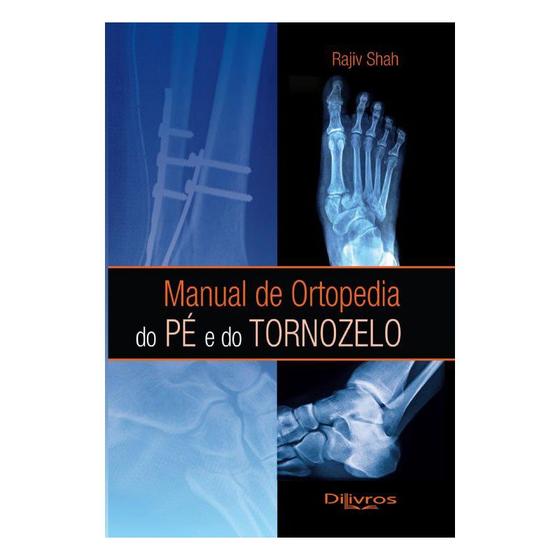 Imagem de Livro - Manual de Ortopedia do Pé e do Tornozelo - Shah - DiLivros