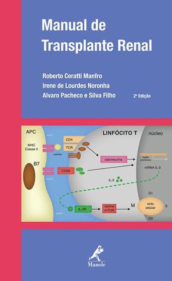 Imagem de Livro - Manual de transplante renal