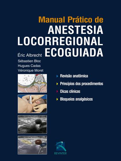 Imagem de Livro - Manual Prático de Anestesia Locorregional Ecoguiada