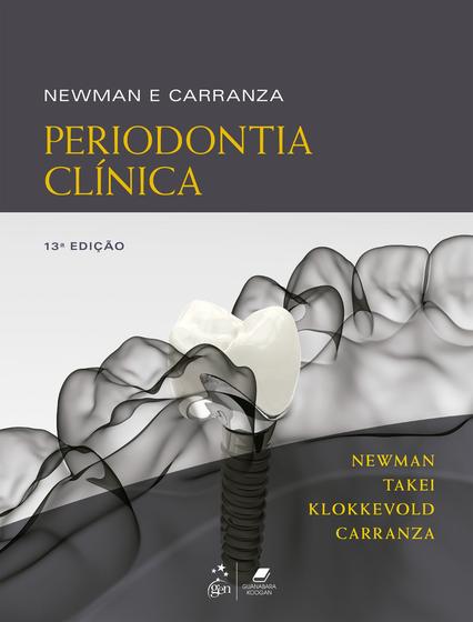 Imagem de Livro - Newman e Carranza - Periodontia Clínica