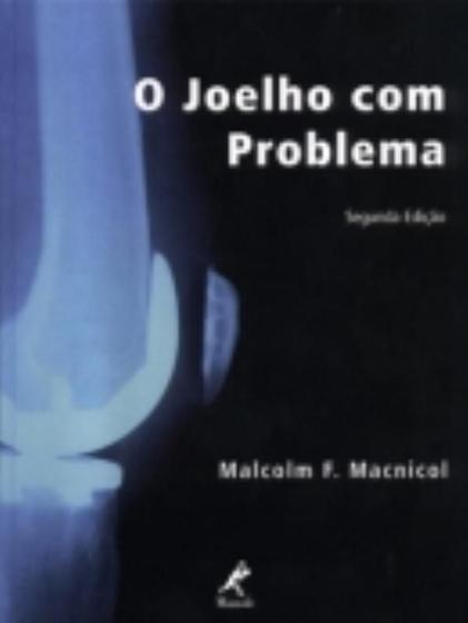 Imagem de Livro - O joelho com problema